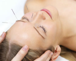 acupunctureresized